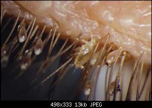Click image for larger version. 

Name:	content-lice-eyelash.jpg 
Views:	616 
Size:	12.7 KB 
ID:	1342